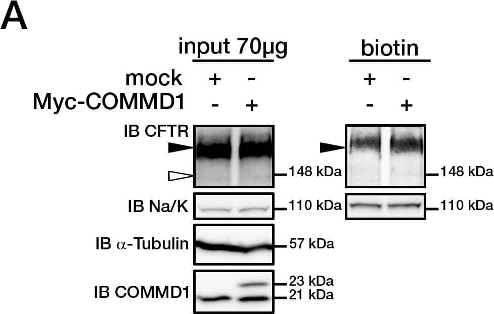 COMMD1 regulates CFTR cell surface expression.(A) HeLa cells stably expressing wt-CFTR were transiently transfected with an empty COMMD1 vector (mock, pcDNA3.1/Topo) or Myc-COMMD1, and were biotinylated with Sulfo-NHS-LC-biotin. Lysates from all these experiments were subjected to SDS-PAGE directly (input) or pulled-down with streptavidin-agarose (biotin). Representative gels for the same samples were separated by 8% SDS-PAGE for CFTR, Na/K-ATPase detection and 11% SDS-PAGE for COMMD1,  alpha -tubulin detection. (B) HeLa cells stably expressing wt-CFTR were transiently transfected with a siCONTROL Non-Targeting siRNA (mock) or COMMD1 siRNA and further processed as in (A). Filled and empty arrowheads indicate the fully- (170 kDa) and core-glycosylated (140 kDa) CFTR, respectively. (C) Quantification of CFTR cell surface expression. The biotinylated CFTR level is normalized to the biotinylated Na/K-ATPase level. Endogenous COMMD1 expression is referred as 100%, with mock being pcDNA3.1/Topo for overexpression experiments (A), whereas mock was siCONTROL for silencing experiments (B). The means ± S.D. were obtained from three independent experiments.* P<0.05 was determined by t-test. (D) Immunofluorescence microscopy of COMMD1 and CFTR in HeLa cells stably expressing wt-CFTR. Cells were transfected with Myc-COMMD1 or COMMD1 siRNA for overexpression and silencing studies, respectively, and not transfected for endogenous expression studies. Two types of light exposure microscopy (short and normal) are shown to visualize all expression conditions. Scale bars: 10 µm. Image collected and cropped by CiteAb from the following open publication (//pubmed.ncbi.nlm.nih.gov/21483833), licensed under a CC-BY license. Not internally tested by R&D Systems.