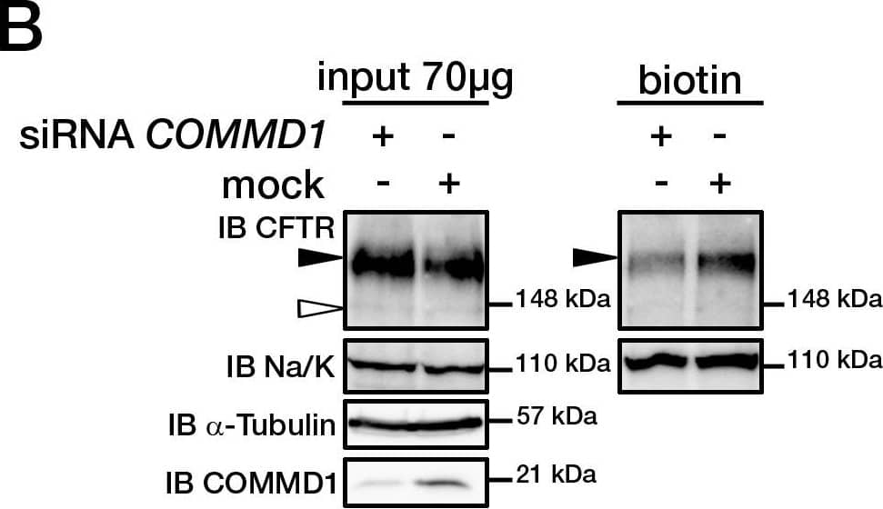 COMMD1 regulates CFTR cell surface expression.(A) HeLa cells stably expressing wt-CFTR were transiently transfected with an empty COMMD1 vector (mock, pcDNA3.1/Topo) or Myc-COMMD1, and were biotinylated with Sulfo-NHS-LC-biotin. Lysates from all these experiments were subjected to SDS-PAGE directly (input) or pulled-down with streptavidin-agarose (biotin). Representative gels for the same samples were separated by 8% SDS-PAGE for CFTR, Na/K-ATPase detection and 11% SDS-PAGE for COMMD1,  alpha -tubulin detection. (B) HeLa cells stably expressing wt-CFTR were transiently transfected with a siCONTROL Non-Targeting siRNA (mock) or COMMD1 siRNA and further processed as in (A). Filled and empty arrowheads indicate the fully- (170 kDa) and core-glycosylated (140 kDa) CFTR, respectively. (C) Quantification of CFTR cell surface expression. The biotinylated CFTR level is normalized to the biotinylated Na/K-ATPase level. Endogenous COMMD1 expression is referred as 100%, with mock being pcDNA3.1/Topo for overexpression experiments (A), whereas mock was siCONTROL for silencing experiments (B). The means ± S.D. were obtained from three independent experiments.* P<0.05 was determined by t-test. (D) Immunofluorescence microscopy of COMMD1 and CFTR in HeLa cells stably expressing wt-CFTR. Cells were transfected with Myc-COMMD1 or COMMD1 siRNA for overexpression and silencing studies, respectively, and not transfected for endogenous expression studies. Two types of light exposure microscopy (short and normal) are shown to visualize all expression conditions. Scale bars: 10 µm. Image collected and cropped by CiteAb from the following open publication (//pubmed.ncbi.nlm.nih.gov/21483833), licensed under a CC-BY license. Not internally tested by R&D Systems.