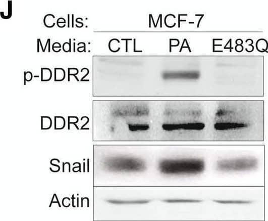 Western Blot DDR1/DDR2 [p Tyr796, p Tyr740, p Tyr740] Antibody (1119D) [Unconjugated]