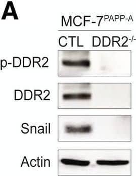 Western Blot DDR1/DDR2 [p Tyr796, p Tyr740, p Tyr740] Antibody (1119D) [Unconjugated]