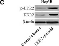 Western Blot DDR1/DDR2 [p Tyr796, p Tyr740, p Tyr740] Antibody (1119D) [Unconjugated]