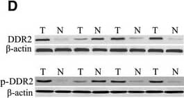 Western Blot DDR1/DDR2 [p Tyr796, p Tyr740, p Tyr740] Antibody (1119D) [Unconjugated]