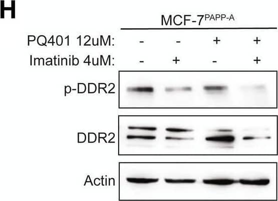 Western Blot DDR1/DDR2 [p Tyr796, p Tyr740, p Tyr740] Antibody (1119D) [Unconjugated]