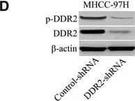 Western Blot DDR1/DDR2 [p Tyr796, p Tyr740, p Tyr740] Antibody (1119D) [Unconjugated]
