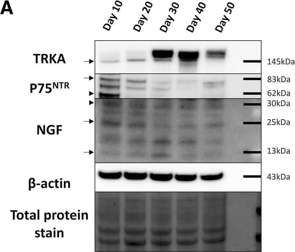 Western Blot beta-NGF Antibody (25623) [Unconjugated]