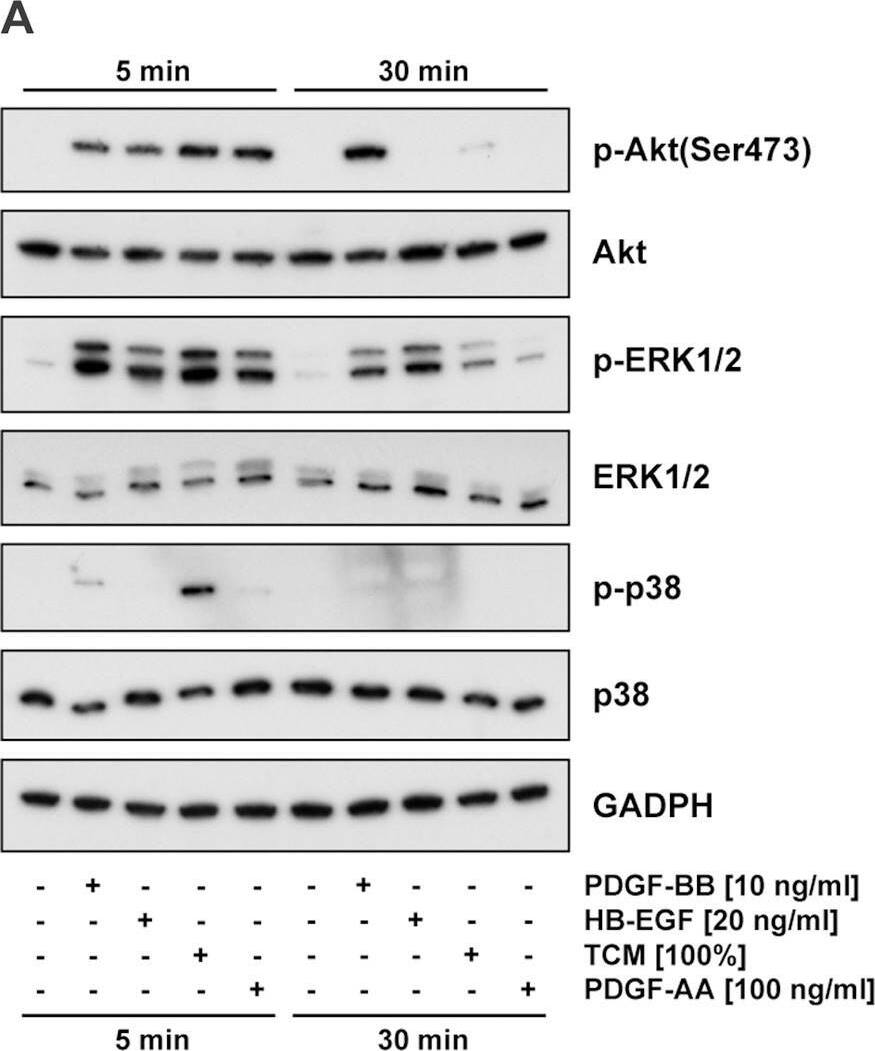 Signaling pathways activated by PDGF-AA, PDGF-BB, HB-EGF, TCM, or VECM.(A) Decidualized St-T1b were starved in Opti-MEM and then treated for 5 or 30 min with PDGF-BB, HB-EGF, TCM or PDGF-AA. Levels of phosphorylated (p-) or total ERK1/2, Akt, and p38 were determined by Western blotting. (B) Decidualized hESC were starved in Opti-MEM and then treated for 5 min with PDGF-BB, HB-EGF, TCM, 5 individual VECM preparations, villous explant control medium (VECM-Co), or PDGF-AA. Western blotting was performed as above. Image collected and cropped by CiteAb from the following open publication (//pubmed.ncbi.nlm.nih.gov/23349855), licensed under a CC-BY license. Not internally tested by R&D Systems.