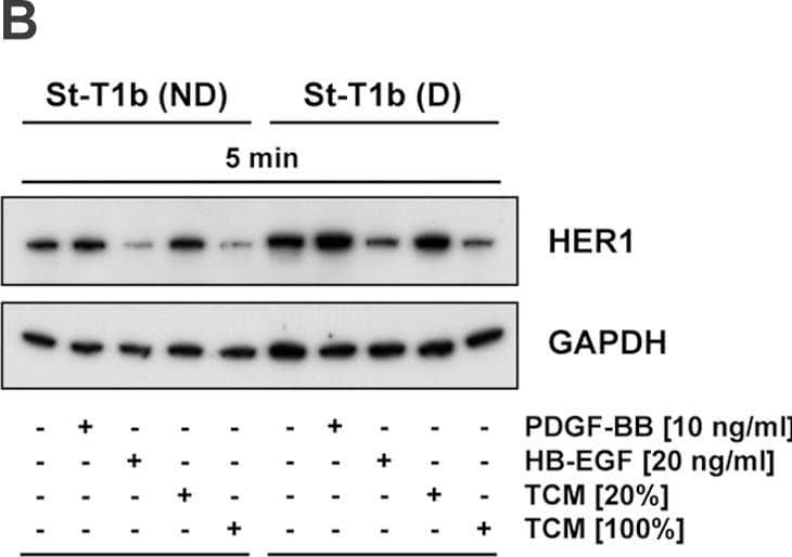 Expression and regulation of HER1 in St-T1b cells and hESCs.(A) Effect of decidualization on HER1 expression. Whole cell extracts from two individual hESC preparations or from St-T1b cells, non-decidualized (−) or decidualized (+), were immunoblotted for HER1 (antibody from New England Biolabs), and for GAPDH as a loading control. In addition, the levels of Nur77,  alpha -SMA, MLC2 and phospho-MLC2 were analyzed. (B, C, D) Time-dependent downregulation of HER1 in response to HB-EGF or TCM. Non-decidualized (ND) or decidualized (D) St-T1b cells, maintained in Opti-MEM, were incubated with PDGF-BB, HB-EGF or TCM (20 or 100%) for 5 min (B) or 5, 30 and 60 min (C) and subjected to Western Blot analysis for HER1 (antibody from Santa Cruz). Decidualized St-T1b cells were stimulated with HB-EGF or TCM (100%) for 5, 30 and 60 min or 24 h (D) and analyzed for HER1 by Western blotting (antibody from Santa Cruz), followed by immunoblotting for phospho-ERK1/2 and phosphorylated (Ser473) and total Akt. Image collected and cropped by CiteAb from the following open publication (//pubmed.ncbi.nlm.nih.gov/23349855), licensed under a CC-BY license. Not internally tested by R&D Systems.