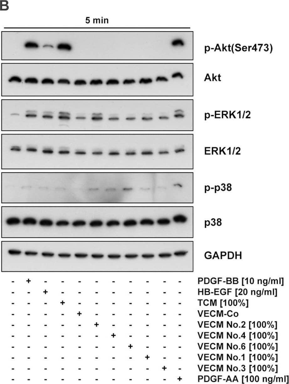 Signaling pathways activated by PDGF-AA, PDGF-BB, HB-EGF, TCM, or VECM.(A) Decidualized St-T1b were starved in Opti-MEM and then treated for 5 or 30 min with PDGF-BB, HB-EGF, TCM or PDGF-AA. Levels of phosphorylated (p-) or total ERK1/2, Akt, and p38 were determined by Western blotting. (B) Decidualized hESC were starved in Opti-MEM and then treated for 5 min with PDGF-BB, HB-EGF, TCM, 5 individual VECM preparations, villous explant control medium (VECM-Co), or PDGF-AA. Western blotting was performed as above. Image collected and cropped by CiteAb from the following open publication (//pubmed.ncbi.nlm.nih.gov/23349855), licensed under a CC-BY license. Not internally tested by R&D Systems.