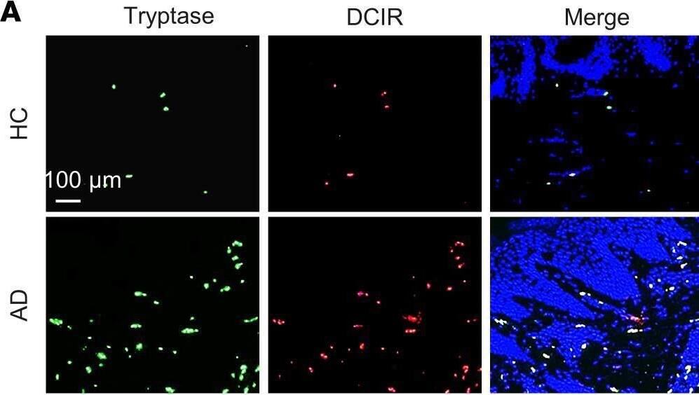 DCIR mediates cockroach allergen binding and uptake.(A and B) Representative immunofluorescence images of dorsal skin sections and fluorescence analysis of DCIR staining in the skin tissues of patients with AD and controls (n = 8). Scale bar: 100 μm. (C) Quantification analysis of DCIR+tryptase+ cells in the lesion skin of patients with AD and controls. (D) Flow cytometry analysis of DCIR expression in human mast cell line cKit+Fc epsilon RI+ LAD2 cells. (E) Scheme of experimental protocol for the direct bindings of human recombinant DCIR (hrDCIR) to BSA, CRE, and Man-BSA. (F) Direct binding of different doses of hrDCIR (0–5.0 μg/mL) to BSA, CRE, or Man-BSA (n = 3). (G) Representative immunofluorescence images of FITC-CRE uptake by LAD2. Scale bar: 15 μm. (H and I) Flow cytometry analysis (H) and quantification (I) of FITC-CRE uptake at different doses (1–500 ng/mL) by LAD2 cells (n = 3). (J) Inhibition of FITC-CRE uptake in LAD2 cells pretreated with DCIR neutralizing antibody ( alpha -DCIR) or IgG isotype (n = 4). Data represent mean ± SEM of 2 independent experiments. Data in B, C, and I were compared using a 2-tailed Student’s t test. Data in F and J were compared by 2-way ANOVA. *P < 0.05, **P < 0.01, ***P < 0.001. Image collected and cropped by CiteAb from the following open publication (//pubmed.ncbi.nlm.nih.gov/35113811), licensed under a CC-BY license. Not internally tested by R&D Systems.