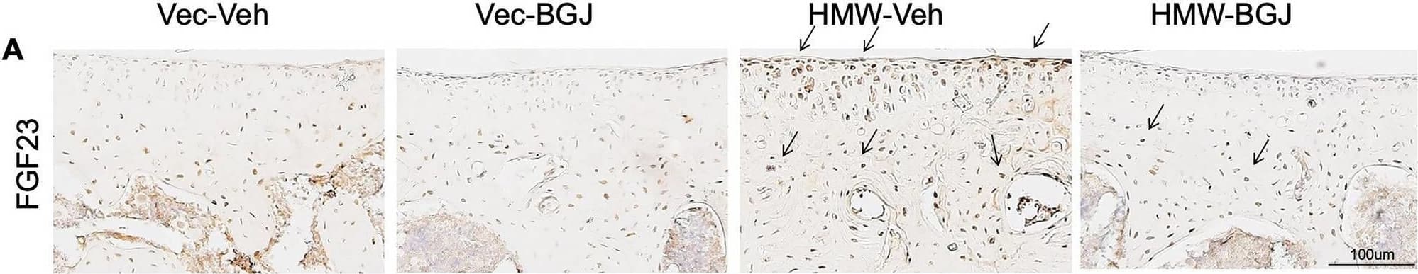 Expression of FGF23 in knee articular cartilage, subchondral bone and serum of 9.5-month-old Vector-Control and HMWTgFGF2 mice treated with BGJ398. Eight-month-old Vector-Control (Vec) and HMWTgFGF2 (HMW) female mice were sq injected with vehicle or BGJ398 5 days/week for 6 weeks. At the end of the experiment (9.5 months old), samples were collected. (A) Representative immunohistochemical staining images for FGF23. Quantitative analysis of percentage of positive staining area of FGF23 in (B) articular cartilage and (C) subchondral bone. (D) Serum intact FGF23 level was measured by ELISA. Data are shown as mean and individual points. n = 7–9 mice/group. *p < 0.05 by two-way ANOVA. Image collected and cropped by CiteAb from the following open publication (//pubmed.ncbi.nlm.nih.gov/36153352), licensed under a CC-BY license. Not internally tested by R&D Systems.