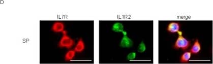 IL7R and IL1R2 were abundantly expressed in HTR-8/SVneo-SP cells.(A) IL7R and IL1R2 mRNA expressions between HTR-8/SVneo-SP and -NSP cells were compared by real-time RT-PCR. The mRNA levels were normalized to those of GAPDH and error bars show standard deviations (n = 3). Asterisk indicates statistically significant (p<0.01). (B) Western blot analysis of IL7R, IL1R2 and CXCR7 proteins in HTR-8/SVneo-SP and -NSP cells. SP cells exclusively expressed IL7R and IL1R2, while NSP exclusively expressed CXCR7. (C) The protein expression of IL7R, IL1R2 or CXCR7 was analyzed by immunocytochemistry. All images counterstained with Hoechst 33852. Each protein expression is shown as green signals (scale bars, 50 µm). (D) IL7R and IL1R2 expressions in HTR-8/SVneo-SP cells were analyzed by immunocytochemistry. All images were counterstained with Hoechst 33852. IL7R and IL1R2 expressions are shown as red and green signals respectively (scale bars, 50 µm). Image collected and cropped by CiteAb from the following open publication (//pubmed.ncbi.nlm.nih.gov/21760941), licensed under a CC-BY license. Not internally tested by R&D Systems.