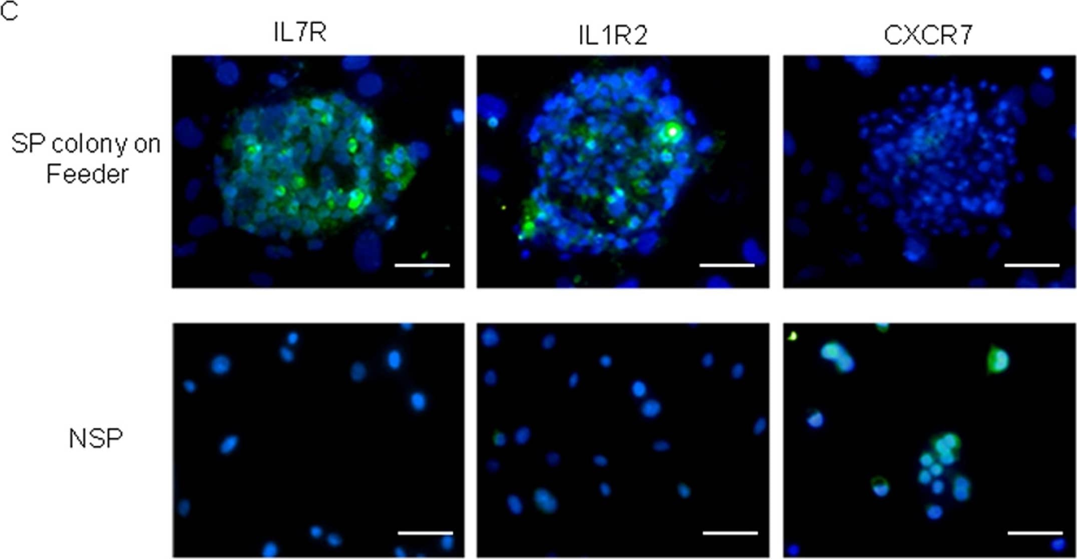 IL7R and IL1R2 were abundantly expressed in HTR-8/SVneo-SP cells.(A) IL7R and IL1R2 mRNA expressions between HTR-8/SVneo-SP and -NSP cells were compared by real-time RT-PCR. The mRNA levels were normalized to those of GAPDH and error bars show standard deviations (n = 3). Asterisk indicates statistically significant (p<0.01). (B) Western blot analysis of IL7R, IL1R2 and CXCR7 proteins in HTR-8/SVneo-SP and -NSP cells. SP cells exclusively expressed IL7R and IL1R2, while NSP exclusively expressed CXCR7. (C) The protein expression of IL7R, IL1R2 or CXCR7 was analyzed by immunocytochemistry. All images counterstained with Hoechst 33852. Each protein expression is shown as green signals (scale bars, 50 µm). (D) IL7R and IL1R2 expressions in HTR-8/SVneo-SP cells were analyzed by immunocytochemistry. All images were counterstained with Hoechst 33852. IL7R and IL1R2 expressions are shown as red and green signals respectively (scale bars, 50 µm). Image collected and cropped by CiteAb from the following open publication (//pubmed.ncbi.nlm.nih.gov/21760941), licensed under a CC-BY license. Not internally tested by R&D Systems.