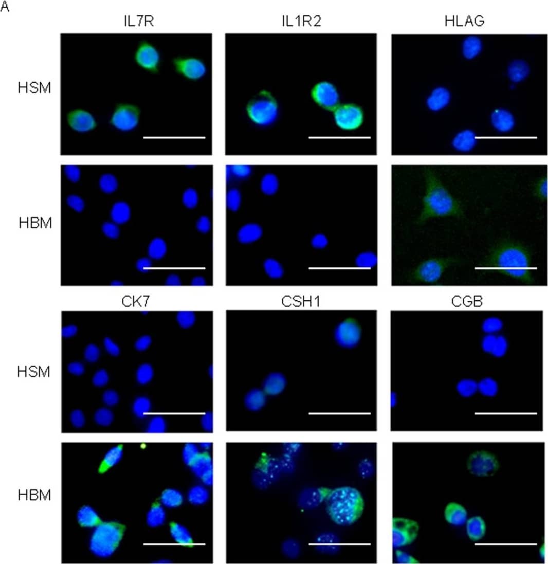 SP and IL1R2/IL7R double-positive cells differentiated into multiple trophoblast cell lineages.(A) Immunocytochemistry images of IL7R, IL1R2, CK7, CSH1, CGB and HLA−G expression in SP cells sorted from HTR-8/SVneo parent cells. Each protein expression is shown as green signals (scale bars, 50 µm). The cells were assayed after culture for 2 weeks in HSM or HBM. (B) Flow cytometry results of IL1R2-positive cells after being sorted by MACS. SP cells were obtained from IL1R2-positive cells after culture for 2 weeks (4.78±1.45% from 3 independent experiments). (C) Induction of trophoblast differentiation of IL7R/IL1R2 double-positive HTR-8/SVneo cells confirmed by differentiation marker, CSH1 and CGB expression. IL7R and IL1R2 expressions are shown as red signals; CSH1 and CGB expressions are shown as green signals (scale bars, 50 µm). The cells marked with an arrow show positive for CSH1 or CGB and negative for IL1R2 or IL7R expression. Image collected and cropped by CiteAb from the following open publication (//pubmed.ncbi.nlm.nih.gov/21760941), licensed under a CC-BY license. Not internally tested by R&D Systems.