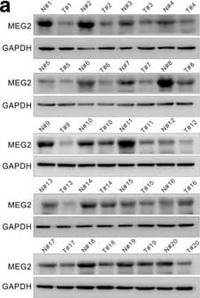Western Blot PTP-MEG2/PTPN9 Antibody (291835) [Unconjugated]