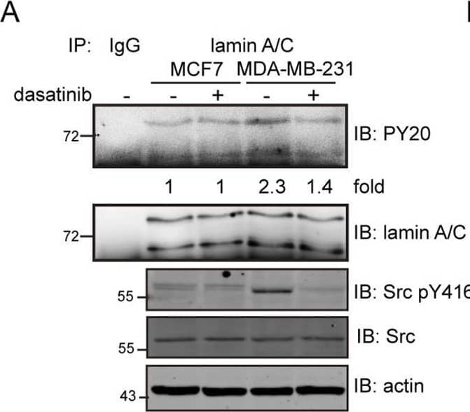 Aberrant phosphorylation of lamin A by Src may cause nuclear dysmorphia.(A) MCF7 and MDA-MB-231 cells were treated with (+) or without (−) 50 nM dasatinib for 1 h and then lysed. Equal amounts of the whole cell lysates (WCLs) were incubated with anti-lamin A/C or pre-immune serum (IgG) as the control. The immunonocomplexes were analyzed by immunoblotting (IB) with anti-PY or anti-lamin A/C antibodies. An equal amount of WCLs was analyzed by immunoblotting with anti-Src, anti-Src pY416, or anti-actin. The tyrosine phosphorylation of lamin A was quantified and expressed as -fold relative to the level of MCF7 without dasatinib. (B) MCF7 and MDA-MB-231 cells were treated with (+) or without (−) 50 nM dasatinib for 1 h. The cells were fixed and stained for lamin A, lamin B1, and DNA. Representative images are shown. Scale bars, 10 μm. The nuclear circularity (4π × area/perimeter2) was determined. The P-values were calculated from at least 150 cells pooled from three independent experiments. The percentage of the cells with nuclear lobulation was measured (n ≥ 400). The values (mean ± SD) are from three experiments. ***P < 0.001. (C) MDA-MB-231 cells were infected with lentivirues capable of expressing FLAG-lamin A or the mutants (Y45F and Y45D) and selected in the medium with neomycin (neo). An equal amount of WCLs was analyzed by immunoblotting (IB) with antibodies as indicated. (D) The cells as described in panel C were fixed and stained for FLAG-lamin A, lamin B1, and DNA. Representative images are shown. Scale bars, 10 μm. The percentage of the cells with nuclear lobulation was measured (n ≥ 900). Values (means ± SD) are from three experiments. *P < 0.05, **P < 0.01, ***P < 0.001.Source data are available for this figure. Image collected and cropped by CiteAb from the following open publication (//pubmed.ncbi.nlm.nih.gov/34385357), licensed under a CC-BY license. Not internally tested by R&D Systems.