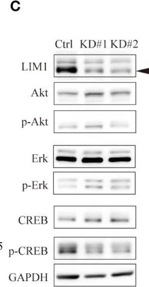 LIM1 promoted CREB phosphorylation in EC. (A) Volcano plot of DEGs in LIM1-KD (#1 and #2) cells versus Ctrl cells generated from RNA-seq results. (B) The highly ranked GO cluster among commonly downregulated genes in LIM1-KD cells compared with Ctrl cells by Ingenuity Pathway Analysis (IPA). (C) Western blotting of LIM1, ERK, phospho-ERK, CREB, phospho-CREB, and GAPDH using Ctrl cells and LIM1-KD cells. (D) Relative intensities of Akt, phospho-Akt, ERK, phospho-ERK, CREB, phospho-CREB bands by western blot analysis. Signals intensities were normalized to the GAPDH intensity in the same samples and then the intensity of the LIM1-KD (#1 and #2) cells were normalized to Ctrl cells [n = 5 (ERK, p-ERK, CREB, p-ERK), n = 4 (Akt, p-Akt) one-way ANOVA]. (E) Immunofluorescent staining for phospho-CREB and human vimentin in sections of xenograft tumors derived from Ctrl cells and LIM1-KD cells. Red: phosphorylated CREB, blue: nucleus, green: human vimentin. (F) Intensity of phospho-CREB in the tumor region (n = 4, one-way ANOVA). *p < 0.05, **p < 0.01. Graphs show means ± standard deviations. (G) MTT assay to assess cell proliferation. HEC50B cells were treated with CREB inhibitors, KG501 and compoun3i, respectively. Red, orange, green and blue indicate inhibitor concentrations at 0.5 μM, 1.0 μM, 5.0 μM and 10 μM, respectively. (n = 5, two-way ANOVA *p < 0.05, **p < 0.01, ***p < 0.001, ****p < 0.0001). Image collected and cropped by CiteAb from the following open publication (//pubmed.ncbi.nlm.nih.gov/36969081), licensed under a CC-BY license. Not internally tested by R&D Systems.