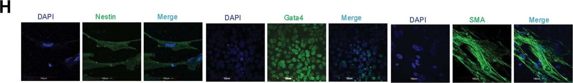 Zfp322a can enhance OSKM reprogramming and replace Sox2.(A) Zfp322a enhanced reprogramming efficiency and accelerated the onset of reprogramming process. OSKM serves as control experiment. (B) The iPSCs generated from OSKM plus Zfp322a presented alkaline phosphatase activity. There were more AP stained colonies generated from OKSM+Zfp322a compare to OKSM. (C) The iPSCs expressed endogenous Oct4, Nanog, Sox2, Rex1 and SSEA-1, indicating that they were ES-cell like. Immunostaining using anti-Oct4, anti-Nanog anti-Sox2, anti-Rex1 and anti-SSEA-1 antibodies were performed with GFP+ iPSCs generated from OKSM+Zfp322a. (D) GFP+ iPSCs generated by OKSM+Zfp322a were able to express ectoderm, mesoderm and endoderm lineage markers in the EB formation assay. iPSCs were stained with anti-Nestin, anti-Gata4 and anti-alpha smooth muscle actin (SMA) antibodies and pictures were taken at 60× magnification. DAPI (blue) served as nucleus marker. (E) Zfp322a was able to replace Sox2, but not Oct4 or Klf4 in OSKM reprogramming process. Results from three independent experiments were presented. (F) iPSCs generated from OKM plus Zfp322a were positive with AP staining and more AP positive colonies were observed in OKM+Zfp322a as compared to OKSM. (G) iPSCs generated by OKM plus Zfp322a expressed pluripotency markers Oct4, Nanog, Sox2, Rex1 and SSEA-1. (H) iPSCs derived from OKM+Zfp322a could differentiate into ectoderm, mesoderm and endoderm lineages, which were showed by anti-Nestin, anti-Gata4, anti-SMA staining respectively. Image collected and cropped by CiteAb from the following open publication (//pubmed.ncbi.nlm.nih.gov/24550733), licensed under a CC-BY license. Not internally tested by R&D Systems.