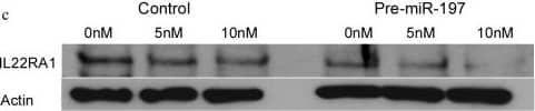 miR-197 suppresses the expression of IL22RA1 by binding to its 3′UTR.a) miR-197 binding site on IL22RA1 3′UTR. b) HEK-293T cells were transfected with psi-CHECK2 vectors encoding luciferase (vector), luciferase fused to the IL22RA1-3′UTR (IL22RA1 wt 3′UTR), or luciferase fused to a mutated in miR-197 binding to the IL22RA1 3′UTR (IL22RA1 mut 3′UTR) together with 2 µg miR-197 expressing plasmid or 2 µg scramble RNA expressing plasmid. Cells transfected with only with vector lacking the IL22RA1 3′UTR was valued as 100%. The error bars are calculated as standard error of at least 6 independent experiments. c) Western blot (WB) analysis of IL22RA1 protein 48 h after transfection with 5/10 nM of scramble control pre-miR or with 5/10 nM of pre-miR-197. d) Densitometry analysis of 4 WBs analysis of IL22RA1 protein 48 h after transfection with 10 nM of scramble control RNA (scramb), or 10 nM pre-miR-197 *p = 0.0000818. Image collected and cropped by CiteAb from the following publication (//pubmed.ncbi.nlm.nih.gov/25208211), licensed under a CC-BY license. Not internally tested by R&D Systems.