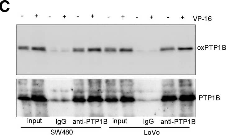 Topoisomerase inhibitors induce JAK2-STAT1-CXCL1 and migration through ROS. a Relative DCFH-DA levels in SW480 and SW620 cells treated with VP-16 (V, 20 μM), ADM (A, 0.2 μg/ml), or CPT-11 (C, 80 μg/ml) for 0.5 h. P, a positive control with Rosup H2O2 (50 μg/ml, 0.5 h). (B) Western blot of oxidized PTPs after treatement with VP-16 (20 μM), ADM (0.2 μg/ml), or CPT-11 (80 μg/ml) for 0.5 h. c Confirmation of VP-16-induced PTP1B oxidization. After treatment with VP-16 (20 μM, 0.5 h), cell lysates (200 μg per sample) were immunoprecipitated with 1 μg anti-PTP1B or pre-immune IgG for 12 h. Precipitates and cell lysates (input, 50 μg per sample) were analyzed by Western blot with anti-oxPTP and anti-PTP1B. d Western blot of JAK2 and STAT1 phosphorylation and CXCL1 expression in cells pretreated with GSH (10 mM) for 2 h and subsequently treated with VP-16 (20 μM) or CPT-11 (80 μg/ml) for 0.5 h. e Migration assay of cells treated with GSH (10 mM) plus VP-16 (20 μM) or CPT-11 for 24 h Image collected and cropped by CiteAb from the following publication (//pubmed.ncbi.nlm.nih.gov/31438997), licensed under a CC-BY license. Not internally tested by R&D Systems.