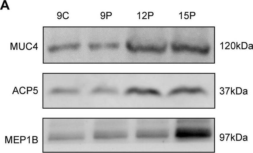 Representative proteins in ULF-EVs whose abundance increased with pregnancy development also significantly increased after ULF-EVs treatment of pTr2 cells. A Western blot analysis of MUC4, ACP5 and MEP1B in ULF-EVs. B Relative abundance of MUC4, ACP5 and MEP1B in pTr2 cells treated with ULF-EVs. C Images of the embryo-maternal interface stained with MEP1B antibodies. MEP1B was obviously expressed in the endometrium and trophoblast. The scale bar indicates 100 nm. D Quantitative analysis of MEP1B by assessing the average integrated optical density (IOD) in the endometrium. The data are displayed as mean ± SD and different lowercase letters correspond to significant differences at the p < 0.05 threshold. E Quantitative analysis of MEP1B by assessing IOD in the trophoblast. Asterisks indicate significant differences (mean ± SD) between 12 and 15P (**p < 0.01). F The relative expression level of MEP1B mRNA was determined by qRT-PCR. The data are displayed as mean ± SD and asterisk indicate significant differences (*p < 0.05) Image collected and cropped by CiteAb from the following open publication (//pubmed.ncbi.nlm.nih.gov/36882792), licensed under a CC-BY license. Not internally tested by R&D Systems.