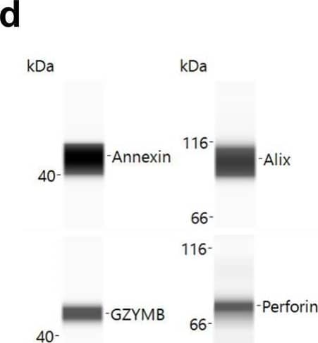 Patient derived NK cells can be expanded in vitro and NKEVs contain protein and nucleic acid cargo reflecting the cells of origin. NK cells were isolated from patient PBMCs via negative selection and EVs were isolated with size exclusion chromatography from the NK cell culture medium (n=20, 10 “pre” and 10 “post) (a). Representative image of cytokine profiling (n=12) of the secretome showed the presence of classic chemokines (CCL1, -5) and cytokines (IFNy, GM-CSF) (b). NKEVs were 100–200 nm in diameter post SEC (n=20) (c) and express canonical EV markers and cytotoxic NK proteins (d). Whole transcriptome sequencing (n=21; 20 patient NKEV and 1 control pool NKEV) found the majority of NKEV RNA cargo is protein coding and long noncoding transcripts (e). Differential gene expression (DE) analysis of LUAD/LUSC NKEVs identified a small number of significantly DE transcripts between LUAD and LUSC, such as ERAP2, which is upregulated in LUAD NKEVs (f). Mass spectrometry proteomics analysis (n=21; 20 patient NKEV and 1 control pool NKEV) of NKEV cargo identified over 4000 proteins (g), and modestly differentially expressed proteins between LUAD and LUSC groups (h). (b) is one representative dot blot, PT007-post and (d) is one representative Western blot, PT007-post. (c) shows NTA analysis for all individual samples in grey, with the mean distribution in red and SEM error bars. Image collected and cropped by CiteAb from the following open publication (//pubmed.ncbi.nlm.nih.gov/40821787), licensed under a CC-BY license. Not internally tested by R&D Systems.