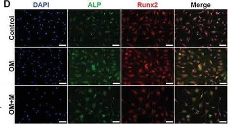 Morusin inhibits OM‐induced osteogenic differentiation of VICs. A) Immunoblot analysis of Runx2 and ALP expression in VICs from indicated groups (n = 3, each group). B) Bar plot showing the fold change of Runx2 expression over control. C) Bar plot showing the fold change of ALP expression over control. D) Immunofluorescent staining of ALP (green), Runx2 (red), and DAPI (blue) in the VICs from indicated groups. Scale bar 50 µm. E,F) With OM induction for 7 days, representative ALP staining of VICs from indicated groups (n = 3, each group). Scale bar 50 µm. G–I) With OM induction for 21 days, representative Alizarin red staining showed the calcific nodules in VICs from indicated groups (n = 3, each group). Scale bar 50 µm. J) With OM induction for 21 days, representative Von Kossa and Alizarin Red staining of aortic valve leaflets. K) Bar plot showing the percentage of Von Kossa positive staining area of indicated groups (n = 3, each group). L) Bar plot showing the percentage of Alizarin Red positive staining area of indicated groups (n = 3, each group). Data are mean ± SD. *p < 0.05; **p < 0.01; ***p < 0.001 (ANOVA with Tukey's multiple comparisons test). Image collected and cropped by CiteAb from the following open publication (//pubmed.ncbi.nlm.nih.gov/38502885), licensed under a CC-BY license. Not internally tested by R&D Systems.