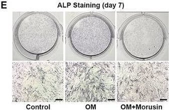 Morusin inhibits OM‐induced osteogenic differentiation of VICs. A) Immunoblot analysis of Runx2 and ALP expression in VICs from indicated groups (n = 3, each group). B) Bar plot showing the fold change of Runx2 expression over control. C) Bar plot showing the fold change of ALP expression over control. D) Immunofluorescent staining of ALP (green), Runx2 (red), and DAPI (blue) in the VICs from indicated groups. Scale bar 50 µm. E,F) With OM induction for 7 days, representative ALP staining of VICs from indicated groups (n = 3, each group). Scale bar 50 µm. G–I) With OM induction for 21 days, representative Alizarin red staining showed the calcific nodules in VICs from indicated groups (n = 3, each group). Scale bar 50 µm. J) With OM induction for 21 days, representative Von Kossa and Alizarin Red staining of aortic valve leaflets. K) Bar plot showing the percentage of Von Kossa positive staining area of indicated groups (n = 3, each group). L) Bar plot showing the percentage of Alizarin Red positive staining area of indicated groups (n = 3, each group). Data are mean ± SD. *p < 0.05; **p < 0.01; ***p < 0.001 (ANOVA with Tukey's multiple comparisons test). Image collected and cropped by CiteAb from the following open publication (//pubmed.ncbi.nlm.nih.gov/38502885), licensed under a CC-BY license. Not internally tested by R&D Systems.