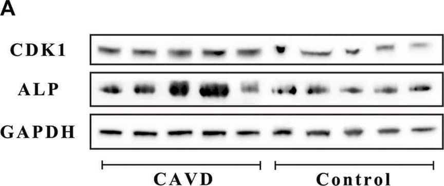 Analysis of the control and CAVD aortic valve samples (n = 5 and 5, respectively). (A) Western blotting for CDK1 and ALP proteins on valve tissues. (B) Semi-quantitative analysis of protein expression. (C) Immunofluorescence staining of CDK1 and Ki-67 on valve tissues. (D) Semi-quantitative analysis of fluorescence intensity. (E) PCR test for cell proliferation genes on valve tissues. (*) p < 0.05 indicates a significant difference. Image collected and cropped by CiteAb from the following open publication (//pubmed.ncbi.nlm.nih.gov/35571082), licensed under a CC-BY license. Not internally tested by R&D Systems.