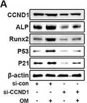 CCND1 participates in the osteogenic differentiation of VICs following OM. A–F) VICs were transfected with CCND1 siRNA or scrambled siRNA, and then stimulated with OM for 7 days. Immunoblot analysis of CCND1, ALP, Runx2 P53, and P21 expression in VICs from indicated groups (n = 3, each group). Bar plots showing the semiquantitative analysis of indicated genes expression. G,H) With OM induction for 7 days, representative ALP staining of VICs from indicated groups (n = 3, each group). Scale bar 50 µm. I–K) With OM induction for 21 days, representative Alizarin red staining showed the calcific nodules in VICs from indicated groups (n = 3, each group). Scale bar 50 µm. L–M) Representative SA‐ beta ‐gal staining of VICs from indicated groups (n = 3, each group). Bar plot showing the percentage of SA‐ beta ‐gal staining positive cells. Scale bar 50 µm. Data are means ± SD. *p < 0.05; **p < 0.01; ***p < 0.001 (ANOVA with Tukey's multiple comparisons test). Image collected and cropped by CiteAb from the following open publication (//pubmed.ncbi.nlm.nih.gov/38502885), licensed under a CC-BY license. Not internally tested by R&D Systems.