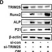 Morusin attenuates VIC calcification depending on Trim25. A,B) VICs were transfected with CCND1 siRNA or scrambled siRNA, immunoblot analysis of Trim25 expression in VICs from indicated groups (n = 3, each group). Bar plots showing the semiquantitative analysis of Trim25 expression. C) VICs were transfected with Trim25 siRNA or scrambled siRNA. Co‐IP analysis of the Keap1 ubiquitination level in VICs from indicated groups (n = 3, each group). D–M) Representative immunoblot images and quantification of the levels of Trim25, ALP, Runx2, and P21 in VICs from indicated groups (n = 3, each group). N,S) VICs were transfected with Trim25 siRNA or scrambled siRNA, representative ALP staining of VICs from indicated groups (n = 3, each group). P,U) VICs were transfected with Trim25 siRNA or scrambled siRNA, representative Alizarin red staining of VICs from indicated groups (n = 3, each group). Scale bar 50 µm. Data are means ± SD. NS, not significant, *p < 0.05, **p < 0.01, ***p < 0.001 (ANOVA with Tukey's multiple comparisons test). Image collected and cropped by CiteAb from the following open publication (//pubmed.ncbi.nlm.nih.gov/38502885), licensed under a CC-BY license. Not internally tested by R&D Systems.