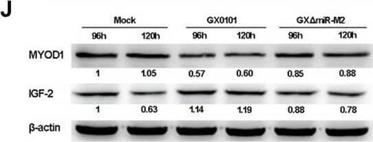 The MYOD1-mediated IGF2 gene expressions and cell viability. (A,B) mRNA and protein expression levels of MYOD1 in CEFs overexpressing distinct siRNAs. (C) Proliferation analysis of MYOD1-silenced CEF cells. CEF cells transfected with MYOD1 siRNAs were harvested at 48 hpt for CCK-8 assay. (D,E) RT-qPCR and western blot analysis of gga-miR-223 and IGF2 expressions in MYOD1-silenced CEF cells at 48 hpt. (F,G) Expression levels of gga-miR-223, MYOD1, and IGF2 proteins in CEFs overexpressing miR-M2-5p determined by RT-qPCR or western blot analysis. (H) Relative signal intensities in western blot analysis of the MYOD1 and IGF2 proteins in CEFs overexpressing miR-M2-5p. (I,J) Expression levels of gga-miR-223, MYOD1, and IGF2 proteins in GaHV-2-infected CEFs determined by RT-qPCR or western blot analysis. (K) Relative signal intensities in western blot analysis of the MYOD1 and IGF2 proteins in GaHV-2-infected CEFs. Numbers were normalized to the corresponding signal from the  beta -actin bands. Error bars are derived from three independent replicates. Values of p indicated on columns were used for statistical analyses; ns, no significance. Image collected and cropped by CiteAb from the following open publication (//pubmed.ncbi.nlm.nih.gov/33224130), licensed under a CC-BY license. Not internally tested by R&D Systems.