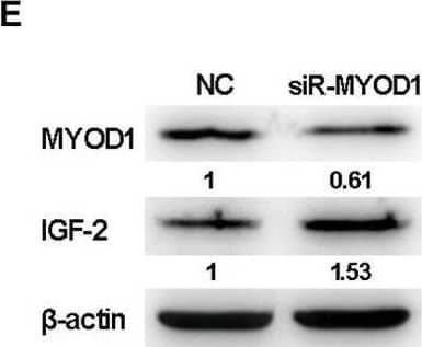 The MYOD1-mediated IGF2 gene expressions and cell viability. (A,B) mRNA and protein expression levels of MYOD1 in CEFs overexpressing distinct siRNAs. (C) Proliferation analysis of MYOD1-silenced CEF cells. CEF cells transfected with MYOD1 siRNAs were harvested at 48 hpt for CCK-8 assay. (D,E) RT-qPCR and western blot analysis of gga-miR-223 and IGF2 expressions in MYOD1-silenced CEF cells at 48 hpt. (F,G) Expression levels of gga-miR-223, MYOD1, and IGF2 proteins in CEFs overexpressing miR-M2-5p determined by RT-qPCR or western blot analysis. (H) Relative signal intensities in western blot analysis of the MYOD1 and IGF2 proteins in CEFs overexpressing miR-M2-5p. (I,J) Expression levels of gga-miR-223, MYOD1, and IGF2 proteins in GaHV-2-infected CEFs determined by RT-qPCR or western blot analysis. (K) Relative signal intensities in western blot analysis of the MYOD1 and IGF2 proteins in GaHV-2-infected CEFs. Numbers were normalized to the corresponding signal from the  beta -actin bands. Error bars are derived from three independent replicates. Values of p indicated on columns were used for statistical analyses; ns, no significance. Image collected and cropped by CiteAb from the following open publication (//pubmed.ncbi.nlm.nih.gov/33224130), licensed under a CC-BY license. Not internally tested by R&D Systems.
