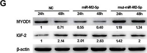 The MYOD1-mediated IGF2 gene expressions and cell viability. (A,B) mRNA and protein expression levels of MYOD1 in CEFs overexpressing distinct siRNAs. (C) Proliferation analysis of MYOD1-silenced CEF cells. CEF cells transfected with MYOD1 siRNAs were harvested at 48 hpt for CCK-8 assay. (D,E) RT-qPCR and western blot analysis of gga-miR-223 and IGF2 expressions in MYOD1-silenced CEF cells at 48 hpt. (F,G) Expression levels of gga-miR-223, MYOD1, and IGF2 proteins in CEFs overexpressing miR-M2-5p determined by RT-qPCR or western blot analysis. (H) Relative signal intensities in western blot analysis of the MYOD1 and IGF2 proteins in CEFs overexpressing miR-M2-5p. (I,J) Expression levels of gga-miR-223, MYOD1, and IGF2 proteins in GaHV-2-infected CEFs determined by RT-qPCR or western blot analysis. (K) Relative signal intensities in western blot analysis of the MYOD1 and IGF2 proteins in GaHV-2-infected CEFs. Numbers were normalized to the corresponding signal from the  beta -actin bands. Error bars are derived from three independent replicates. Values of p indicated on columns were used for statistical analyses; ns, no significance. Image collected and cropped by CiteAb from the following open publication (//pubmed.ncbi.nlm.nih.gov/33224130), licensed under a CC-BY license. Not internally tested by R&D Systems.