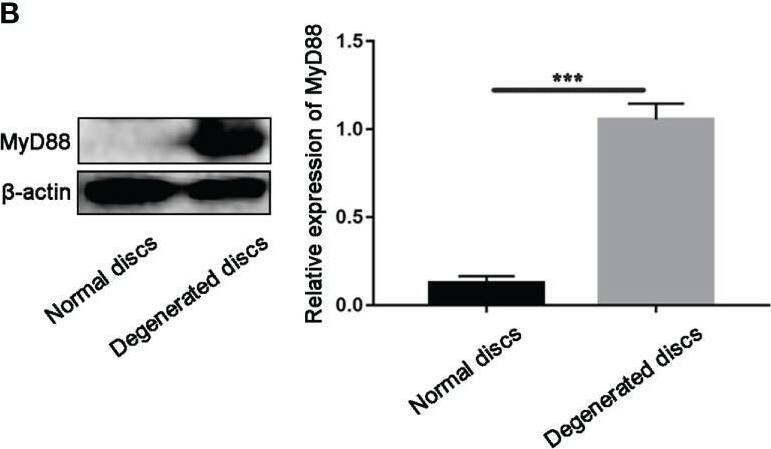 Expression of MyD88 in normal and degenerated disc. (A) The correlations of the expression of the MyD88 with IVDD grades by linear regression analysis. (“0.00” means early stage-thompson grade III, IV, “1.00” means advanced stage-thompson grade V). (B) Detection of MyD88 levels in normal and degenerated disc by western blot. ***P < 0.001. (C) Double-staining of RIP3 with MyD88 in NP cells in normal and degenerated disc. (D) Relative IF intensity of MyD88 in NP cells. ***P < 0.001. N = 6. Bar = 50μm. Image collected and cropped by CiteAb from the following open publication (//pubmed.ncbi.nlm.nih.gov/36213280), licensed under a CC-BY license. Not internally tested by R&D Systems.