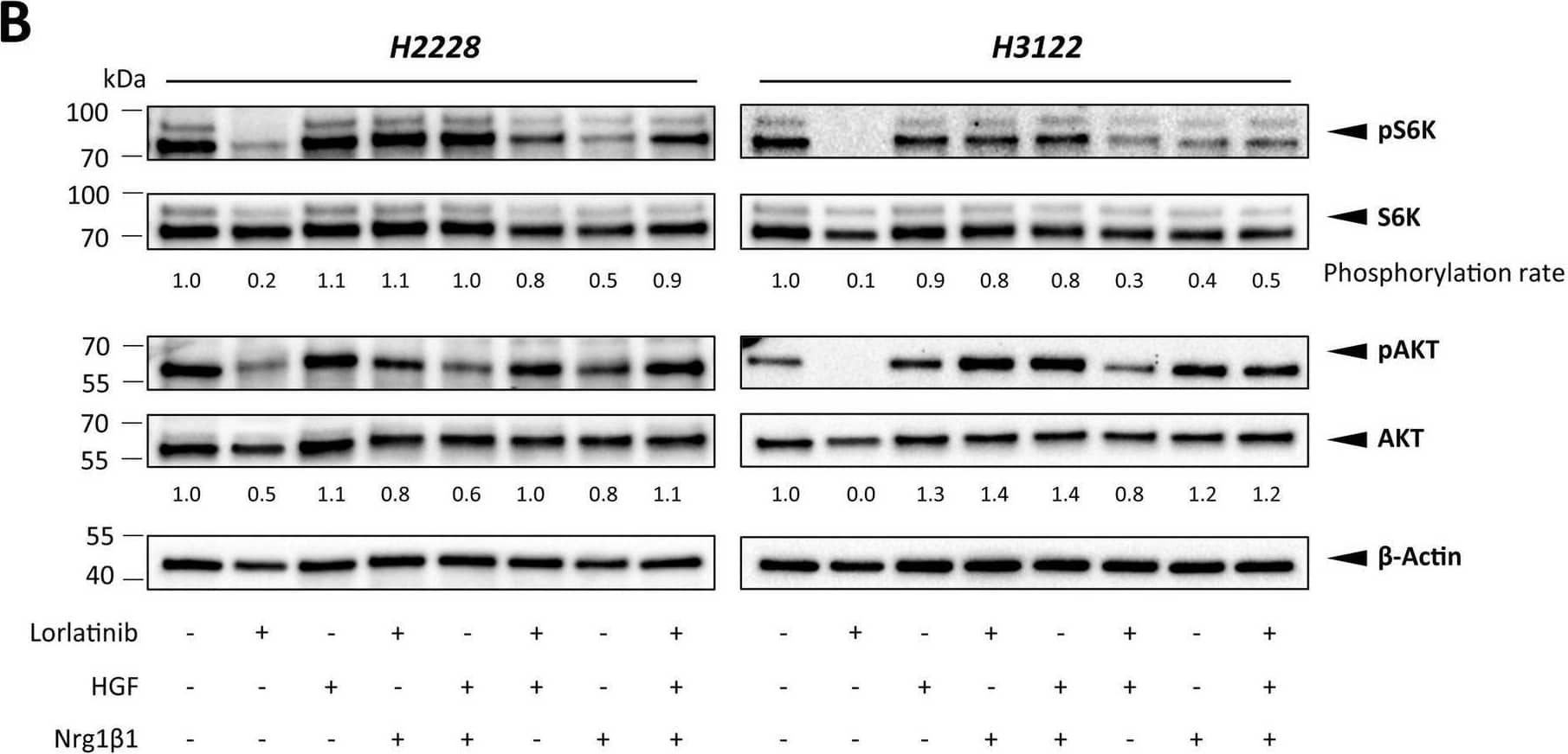 FB2-conditioned medium (CM) (A) and CAF-associated ligands HGF and Nrg1 beta 1 (B) influence the activation of AKT signaling upon ALK signaling perturbation via lorlatinib in H2228 and H3122 cells, as shown by representative western blots of AKT/pAKT and S6K/pS6K in H2228 and H3122 cells. Phosphorylation rates were normalized to those of  beta -actin. AKT, protein kinase B; S6K, ribosomal S6 kinase Image collected and cropped by CiteAb from the following open publication (//pubmed.ncbi.nlm.nih.gov/40524253), licensed under a CC-BY license. Not internally tested by R&D Systems.