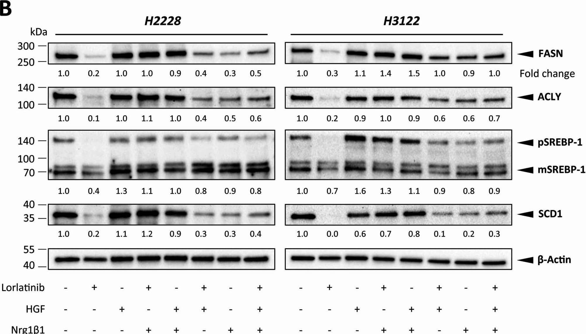 FB2-conditioned medium (CM) (A) and CAF-associated ligands HGF and Nrg1 beta 1 (B) influence the expression of fatty acid metabolism-regulating targets upon ALK signaling perturbation via lorlatinib in H2228 and H3122 cells, as shown by representative western blots of FASN, ACLY, and SREBP-1 in H2228 and H3122 cells. Expression fold changes were normalized to those of  beta -actin. ACLY, ATP-citrate lyase; FASN, fatty acid synthase; pSREBP-1, precursor sterol-responsive element binding protein-1; mSREBP-1, mature SREBP-1 Image collected and cropped by CiteAb from the following open publication (//pubmed.ncbi.nlm.nih.gov/40524253), licensed under a CC-BY license. Not internally tested by R&D Systems.