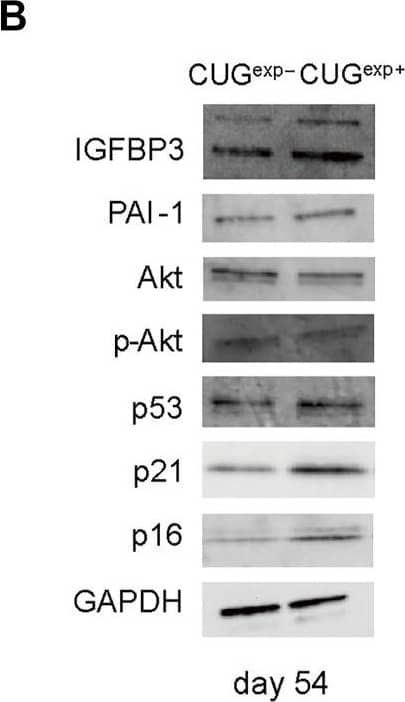 Expanded CUG repeat RNA alters gene and protein expression levels related to cellular senescence. (A) Gene expression levels of MMP family genes (MMP1 and MMP3) (top left), Nrf2 target genes (NQ O 1 and HMOX1) (top right), secreted mediators of senescence genes (IGFBP3 and SERPINE1) (bottom left), and cell cycle checkpoint genes (TP53, CDKN1A, and CDKN2A) (bottom right) determined by qRT-PCR in cells not expressing CUGexp (CUGexp−) and cells expressing CUGexp (CUGexp+) cells at days 51 and 63. Values are presented as means ± SD of three independent experiments. *p < 0.05, **p < 0.01, and ***p < 0.001. (B) Representative images of western blots of IGFBP3, PAI-1, Akt, phospho-Akt (Ser437), p53, p21, and p16 proteins in CUGexp− and CUGexp+ cells at day 54 (left). GAPDH was used as the loading control. Bar graph shows quantification of the immunoblot (right). Values are presented as means ± SD of three independent experiments. *p < 0.05, **p < 0.01, and ***p < 0.001. (C) IGFBP3 levels in the culture medium of CUGexp− and CUGexp+ cells at day 54. Values are presented as means ± SD of three independent experiments. ***p < 0.001. Image collected and cropped by CiteAb from the following open publication (//pubmed.ncbi.nlm.nih.gov/35401669), licensed under a CC-BY license. Not internally tested by R&D Systems.