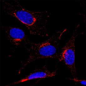 PDGF R alpha  was detected in immersion fixed NIH‑3T3 mouse embryonic fibroblast cell line using Rat Anti-Mouse PDGF R alpha  Monoclonal Antibody (Catalog # MAB3221) at 8 &micro;g/mL for 3 hours at room temperature. Cells were stained using the NorthernLights&trade; 557-conjugated Anti-Rat IgG Secondary Antibody (red; NL013) and counterstained with DAPI (blue). Specific staining was localized to cell surface. Staining was performed using our protocol for Fluorescent ICC Staining of Non-adherent Cells.