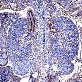 PDGF R alpha  was detected in immersion fixed paraffin-embedded sections of 13 d.p.c. mouse embryos using Rat Anti-MousePDGF R alpha  Monoclonal Antibody (Catalog # MAB3221) at 5 &micro;g/mL for 1 hour at room temperature followed by incubation with the Anti-Rat IgG VisUCyte&trade; HRP Polymer Antibody (VC005). Before incubation with the primary antibody, tissue was subjected to heat-induced epitope retrieval using Antigen Retrieval Reagent-Basic (CTS013). Tissue was stained using DAB (brown) and counterstained with hematoxylin (blue). Specific staining was localized to embryonic kidney. Staining was performed using our protocol for IHC Staining with VisUCyte HRP Polymer Detection Reagents.