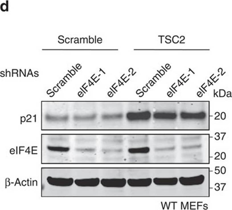 mTORC1-mediated upregulation of p21 requires 4E-BP1 phosphorylation.(a) Effect of mTOR inhibitors torin-1 (250 nM) and rapamycin (100 nM) on p21 levels in different cell lines. Cells were treated for 24 h with the indicated drugs and protein levels were subsequently analysed by western blot. (b) Protein levels in MEFs infected simultaneously with lentiviruses expressing either scramble or TSC2 shRNAs together with control or 4E-BP1-4A. (c) Protein levels in U2OS, HCT116 and 293T cells transfected with 4E-BP1-4A mutant alone (U2OS and HCT116 cells) or in combination with pBabe-p21 plasmid (293T cells). (d) Western blot depicting protein levels in MEFs following co-infection with lentiviruses expressing the indicated shRNAs. (e) Primary MEFs were infected with lentiviruses expressing scramble, TSC2 or eIF4E shRNAs in combination with control or 4E-BP1-4A. Protein levels were measured by immunoblotting. For each panel, all the western blots correspond to samples from the same experiment; in some cases, samples were distributed in several electrophoretic gels run in parallel. Image collected and cropped by CiteAb from the following open publication (//pubmed.ncbi.nlm.nih.gov/26832959), licensed under a CC-BY license. Not internally tested by R&D Systems.