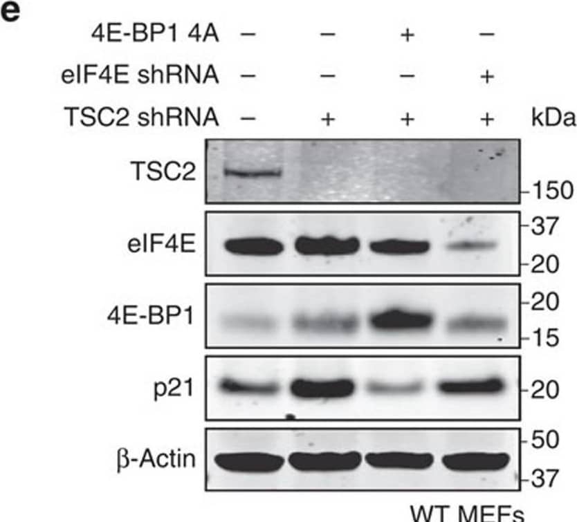 mTORC1-mediated upregulation of p21 requires 4E-BP1 phosphorylation.(a) Effect of mTOR inhibitors torin-1 (250 nM) and rapamycin (100 nM) on p21 levels in different cell lines. Cells were treated for 24 h with the indicated drugs and protein levels were subsequently analysed by western blot. (b) Protein levels in MEFs infected simultaneously with lentiviruses expressing either scramble or TSC2 shRNAs together with control or 4E-BP1-4A. (c) Protein levels in U2OS, HCT116 and 293T cells transfected with 4E-BP1-4A mutant alone (U2OS and HCT116 cells) or in combination with pBabe-p21 plasmid (293T cells). (d) Western blot depicting protein levels in MEFs following co-infection with lentiviruses expressing the indicated shRNAs. (e) Primary MEFs were infected with lentiviruses expressing scramble, TSC2 or eIF4E shRNAs in combination with control or 4E-BP1-4A. Protein levels were measured by immunoblotting. For each panel, all the western blots correspond to samples from the same experiment; in some cases, samples were distributed in several electrophoretic gels run in parallel. Image collected and cropped by CiteAb from the following open publication (//pubmed.ncbi.nlm.nih.gov/26832959), licensed under a CC-BY license. Not internally tested by R&D Systems.