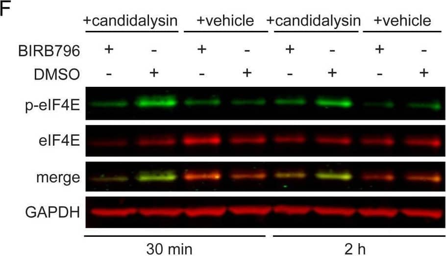 p38 and ERK1/2 trigger distinct patterns of cytokine release. A, Heatmap of the release of IL-1 alpha , IL-1 beta , IL-6, GM-CSF, and G-CSF by TR146 OECs at 24 h post-candidalysin stimulation in the presence of BIRB796, SP600125, Trametinib, or Gefitinib. The heatmap was generated from the data in fig. S2A. B, Release of GM-CSF from TR146 cells transfected with a pool of Hsp27-targeted siRNAs 72 h prior to candidalysin stimulation for 24 h. Graph shows means of three biological replicates + SD and is expressed as fold change relative to siRNA control + candidalysin. C, Relative expression of IL6 6 h post-candidalysin stimulation in the presence of BIRB796. Graph shows means of three biological replicates + SD and is expressed as fold change relative to DMSO + candidalysin. D and E, IL-6 released into the supernatant D, and present in cell extracts E, before (0 h), after 6 h and after 24 h of candidalysin treatment with or without BIRB796. Graphs show means of three biological replicates + SD and are expressed as fold change relative to DMSO + candidalysin at 24 h. F, Representative immunoblot showing phosphorylated (p-) and total eIF4E 30 min and 2 h post-candidalysin stimulation in the presence of BIRB796. Immunoblots are representative of three biological replicates. GAPDH is a loading control. G, Graphical quantification of immunoblots as in F. Scatter plot shows the mean ± SD of three biological replicates expressed as ratios of p-eIF4E/eIF4E. Statistical significance for B and C was quantified by one sample t test compared to a hypothetical value = 1. Statistical significance in D, E and G was quantified by paired t-tests as indicated in the graphs. *P < 0.05, **P < 0.01, ***P < 0.001. Image collected and cropped by CiteAb from the following open publication (//pubmed.ncbi.nlm.nih.gov/35380879), licensed under a CC-BY license. Not internally tested by R&D Systems.