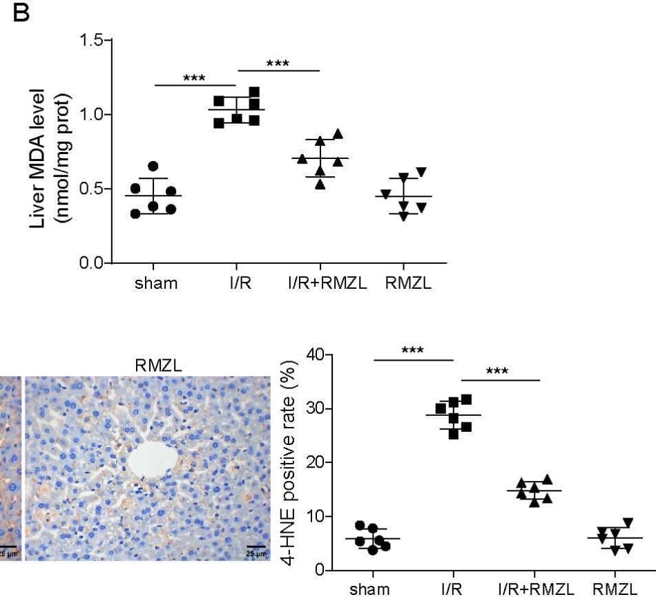 RMZL suppressed oxidative stress and inflammation in HIRI mice. Mice were subjected to ischemia for 1 h and then reperfusion for 6 h through liver surgery, and followed by RMZL treatment. (A) SOD and MDA levels in the left hepatic tissues were determined using commercial kits. (C) 4-HNE expression in the left hepatic tissues was detected by IHC. (D) The levels of TNF-alpha , IL-1 beta , IL-6 and IL-10 in serum from mice were evaluated using ELISA. All data were indicated as mean ± SD (n = 6 per group). *P < 0.05, **P < 0.01, ***P < 0.001 Image collected and cropped by CiteAb from the following open publication (//pubmed.ncbi.nlm.nih.gov/40263992), licensed under a CC-BY license. Not internally tested by R&D Systems.