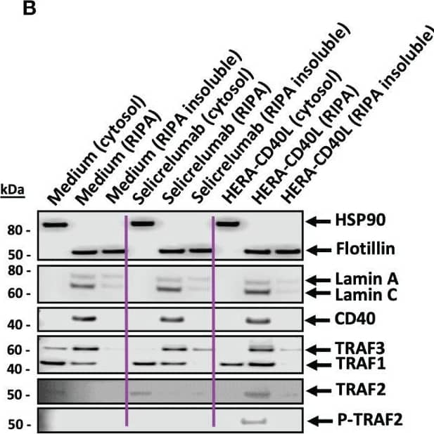 Analysis of the activity of CD40 related proteins involved in transduction leading to activation of key inflammatory/survival pathway and transcription factors. (A, B) Immature dendritic cells were differentiated from monocytes derived from PBMCs donors and treated with the indicated treatments over 4 hours. (A) Representative western blot analysis (n=3-6) of CD40 related signaling adaptor proteins and related inflammatory/survival pathway and transcription factors using beta-actin as a loading control. HERA-CD40L treatment is highlighted by purple rectangles shaded by timepoints. (B) Representative subcellular fractionation and western blot analysis 15 minutes after treatment (n=3), the indicated subcellular fractions are determined by cytosolic, RIPA soluble and insoluble samples, as indicated. RIPA samples correspond to membrane and nuclear fractions while RIPA insoluble samples correspond to insoluble lipid rafts, nuclear insoluble fraction, and bound nuclear chromatin. (C) Dendritic cell activation surface marker expression analysis and IL-12 production comparison between the indicated treatments. Data displayed as mean +/- SEM (n=3 donors), Standard unpaired t-test comparison. Statistics are represented as either not significant (ns), p-value = <0.05 (*), or p-value = <0.005 (***). Image collected and cropped by CiteAb from the following open publication (//pubmed.ncbi.nlm.nih.gov/37304285), licensed under a CC-BY license. Not internally tested by R&D Systems.