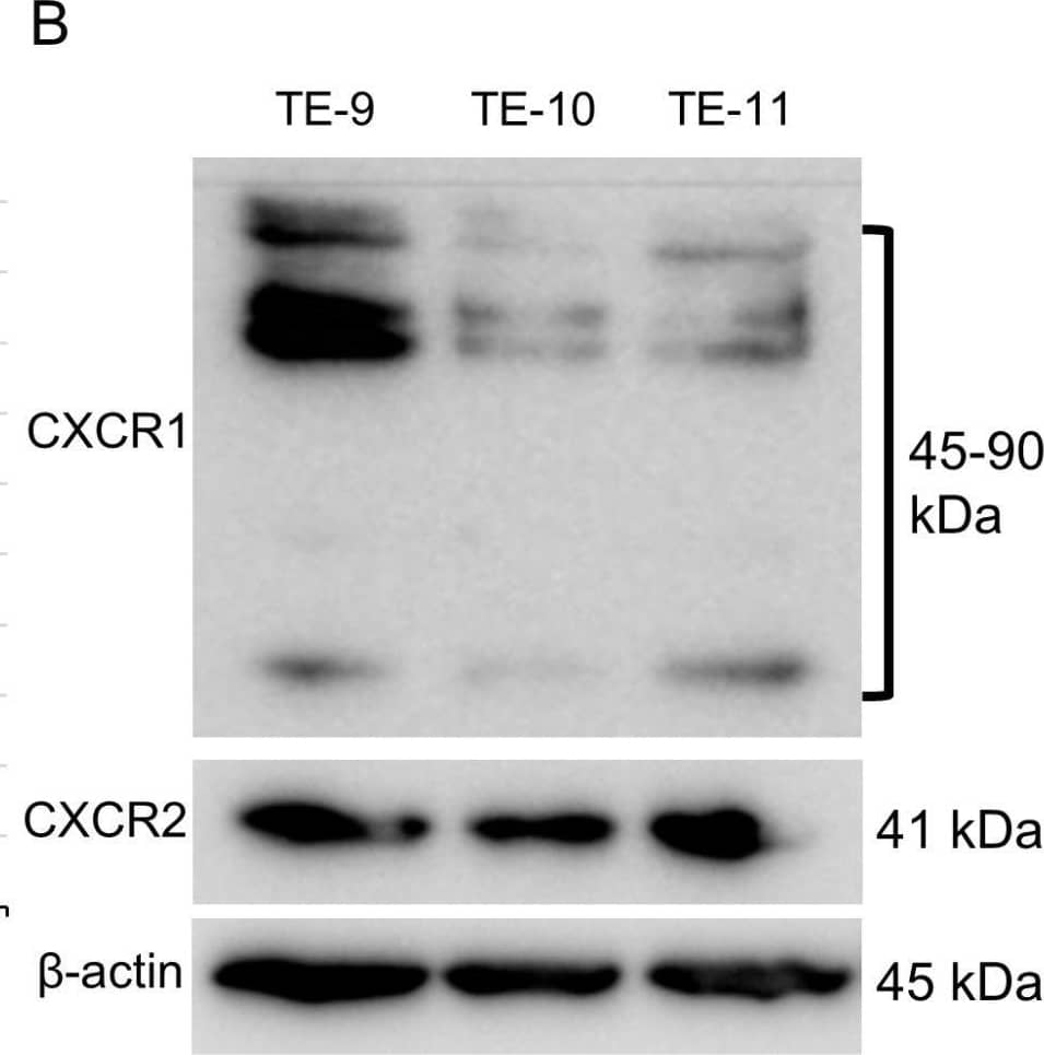 IL-8 as a partial inducer of MMP9 in ESCC cells. (A): ELISA quantification of IL-8 in culture supernatants of ESCC cells after direct co-culture with macrophages. Directly co-cultured ESCC cells secreted more IL-8 than monocultured counterparts. (B): Western blot revealed the expression of known IL-8 receptors, CXCR1 (45 kDa, monomer; 80–90 kDa, dimer and their glycosylated forms) and CXCR2 (41 kDa) in TE-9, TE-10, and TE-11 cell lines. (C,D): Treatment with rhIL-8 (100 ng/mL, for 24 h) upregulated MMP9 mRNA expression in all three ESCC cell lines (C) but only triggered MMP9 secretion from TE-10 (D). Data are expressed as mean ± SEM; * p < 0.05, ** p < 0.01, *** p < 0.001. NS, not significant. Image collected and cropped by CiteAb from the following open publication (//pubmed.ncbi.nlm.nih.gov/37296952), licensed under a CC-BY license. Not internally tested by R&D Systems.