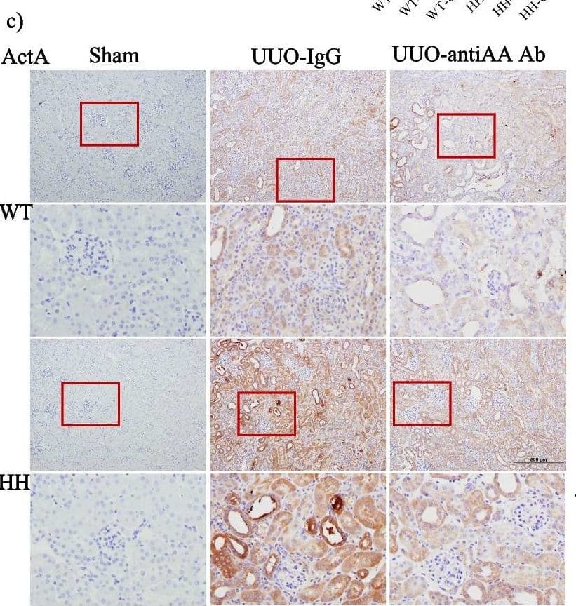 Immunohistochemistry Activin A Antibody (69403) - beta A subunit