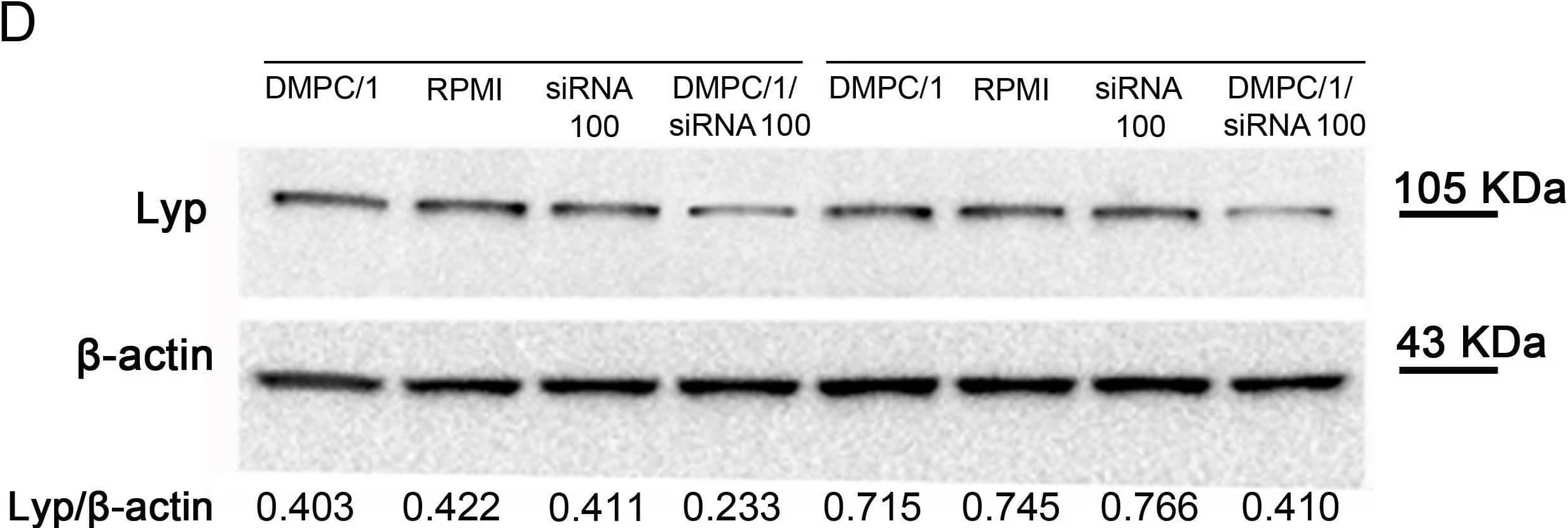 Lyp protein expression in Jurkat T cells 72 hours after the beginning of O/N transfection with different doses of siRNA s/a in DMPC/1/siRNA lipoplexes.Representative duplicate experiment among all replicas in S4 Fig. (A) Lyp expression in Jurkat T cells after O/N transfection with DMPC/1 alone (DMPC/1), 20 pmols of siRNA alone (siRNA20) and 20 pmols of siRNA complexed with DMPC/1 (DMPC/1/siRNA20) or cultured in RPMI. 20 pmols of siRNA complexed with DMPC/1 resulted in a 15% reduction of Lyp expression. (B) Same experiment as in A using 60 pmols of siRNA (siRNA60) complexed with DMPC/1 (DMPC/1/siRNA60). 33% reduction of Lyp expression was obtained. (C) Same experiment as in A using 100 pmols of siRNA (siRNA100) complexed with DMPC/1 (DMPC/1/siRNA100). 45% reduction of Lyp expression was obtained. (D) Representative WB image within all experimental groups is shown. Image collected and cropped by CiteAb from the following open publication (//pubmed.ncbi.nlm.nih.gov/28437437), licensed under a CC-BY license. Not internally tested by R&D Systems.