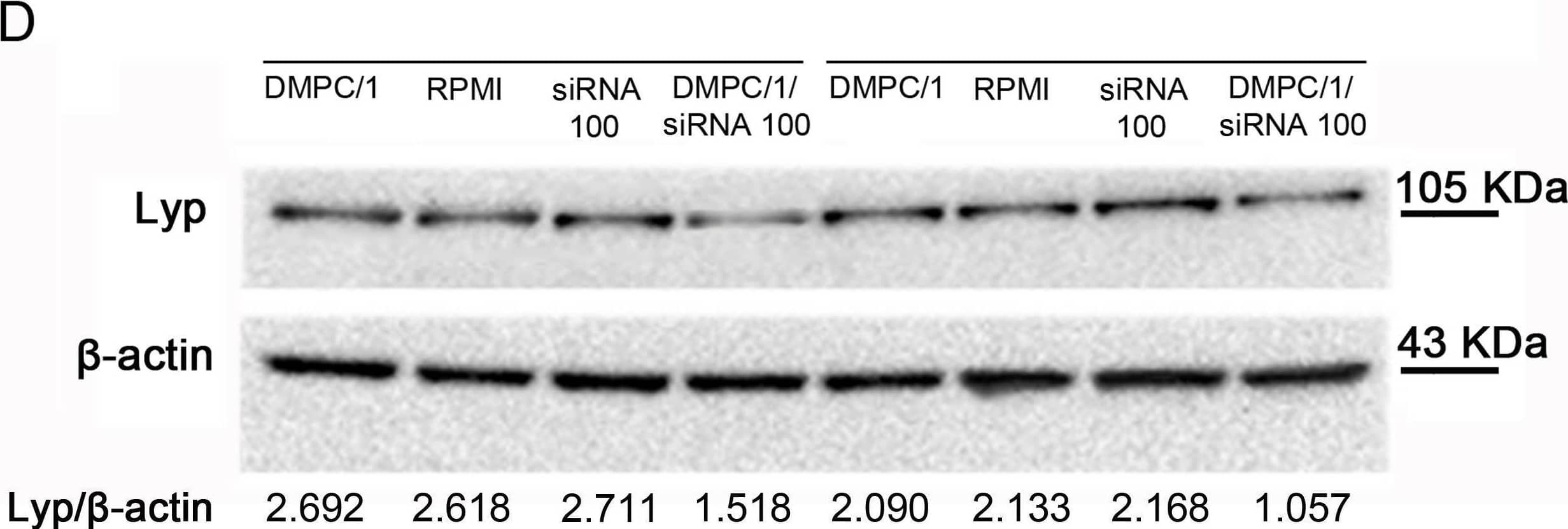 Lyp protein levels in Jurkat T cells 48 hours after the beginning of O/N transfection with different doses of siRNA s/a in DMPC/1/siRNA lipoplexes.Representative duplicate experiment among all replicas in S4 Fig. (A) Lyp expression in Jurkat T cells cultured in RPMI or after O/N transfection with DMPC/1, 20 pmols of siRNA and 20 pmols of siRNA in DMPC/1/siRNA lipoplexes (DMPC/1/siRNA20). 20 pmols of siRNA complexed with DMPC/1 resulted in a 31% reduction of Lyp expression. (B) Same experiment as in A using 60 pmols of siRNA complexed with DMPC/1 (DMPC/1/siRNA60). 39% reduction of Lyp expression was obtained. (C) Same experiment as in A using 100 pmols of siRNA complexed with DMPC/1 lipoplexes (DMPC/1/siRNA100). 47% reduction of Lyp expression was obtained. (D) Representative WB image within all experimental groups is shown. Under each blot Lyp O.D. values for every treatment are normalized over the corresponding  beta -actin values. All percentages were expressed relatively to untransfected cells (RPMI) that is considered the 100% of basal Lyp expression. Graphs A, B, C show the mean values and their standard deviations. In all experimental conditions (vide infra), a decrease in Lyp protein level was not observed in cells treated with the liposome alone or, more importantly, in cells treated with the correspondent dose of the siRNA s/a free molecule. Image collected and cropped by CiteAb from the following open publication (//pubmed.ncbi.nlm.nih.gov/28437437), licensed under a CC-BY license. Not internally tested by R&D Systems.