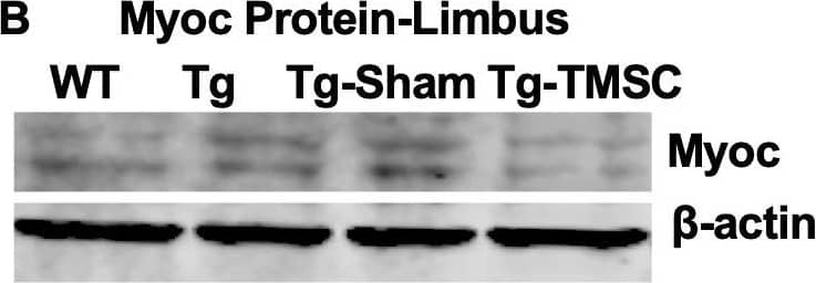 TMSCs reduce the Myoc retention in the TM tissue, promote the Myoc secretion into the aqueous humor, and reverse the ECM expression in the Tg-MyocY437H mice.(A) Immunofluorescent staining shows accumulated Myoc in the TM, iris, and ciliary body of the Tg and Tg-sham mice. TMSC transplantation alleviated the aggregation of Myoc in the TM, similar to the WT mice. Scale bars, 50 mm. Western blotting results show: (B) The representative bands of Myoc expression in the mouse limbal tissue and the relative Myoc protein levels with b-actin as internal control (n=5). (C) The representative bands of Myoc expression in the mouse aqueous humor and the relative Myoc protein levels with b-actin as internal control (n=5). (D) The representative bands of the expression of ECM components fibronectin (FN), collagen IV, and elastin in the limbal tissue and the relative ECM protein levels with b-actin as internal control (n=4-6). Data are presented as mean ± SD. One-way ANOVA (B,C) or two-way ANOVA (D) followed by Tukey’s multiple comparisons test. C: cornea, SC: Schlemm’s canal, TM: trabecular meshwork.Figure 5—source data 1.Relative myocilin protein levels in the corneal limbus for Figure 5B.Relative myocilin protein levels in the aqueous humor of each eye for Figure 5C; Relative extracellular mactrix protein levels in the corneal limbus for Figure 5D.Relative myocilin protein levels in the corneal limbus for Figure 5B.Relative myocilin protein levels in the aqueous humor of each eye for Figure 5C; Relative extracellular mactrix protein levels in the corneal limbus for Figure 5D. Image collected and cropped by CiteAb from the following open publication (https://pubmed.ncbi.nlm.nih.gov/33506763), licensed under a CC-BY license. Not internally tested by R&amp;D Systems.