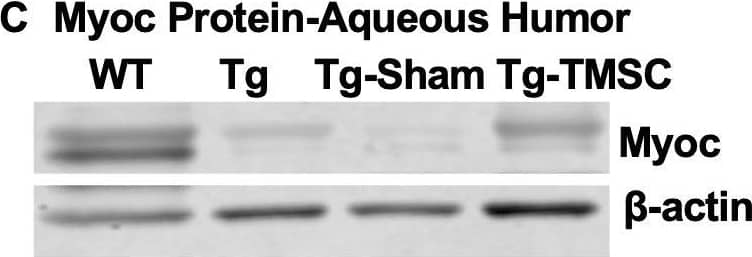 TMSCs reduce the Myoc retention in the TM tissue, promote the Myoc secretion into the aqueous humor, and reverse the ECM expression in the Tg-MyocY437H mice.(A) Immunofluorescent staining shows accumulated Myoc in the TM, iris, and ciliary body of the Tg and Tg-sham mice. TMSC transplantation alleviated the aggregation of Myoc in the TM, similar to the WT mice. Scale bars, 50 mm. Western blotting results show: (B) The representative bands of Myoc expression in the mouse limbal tissue and the relative Myoc protein levels with b-actin as internal control (n=5). (C) The representative bands of Myoc expression in the mouse aqueous humor and the relative Myoc protein levels with b-actin as internal control (n=5). (D) The representative bands of the expression of ECM components fibronectin (FN), collagen IV, and elastin in the limbal tissue and the relative ECM protein levels with b-actin as internal control (n=4-6). Data are presented as mean ± SD. One-way ANOVA (B,C) or two-way ANOVA (D) followed by Tukey’s multiple comparisons test. C: cornea, SC: Schlemm’s canal, TM: trabecular meshwork.Figure 5—source data 1.Relative myocilin protein levels in the corneal limbus for Figure 5B.Relative myocilin protein levels in the aqueous humor of each eye for Figure 5C; Relative extracellular mactrix protein levels in the corneal limbus for Figure 5D.Relative myocilin protein levels in the corneal limbus for Figure 5B.Relative myocilin protein levels in the aqueous humor of each eye for Figure 5C; Relative extracellular mactrix protein levels in the corneal limbus for Figure 5D. Image collected and cropped by CiteAb from the following open publication (//pubmed.ncbi.nlm.nih.gov/33506763), licensed under a CC-BY license. Not internally tested by R&D Systems.